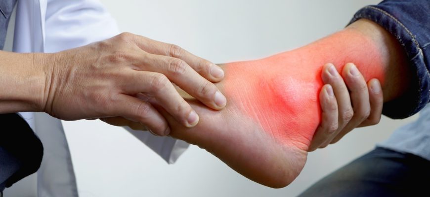 Что делать с подагрой на ногах и как выявить причины заболевания
